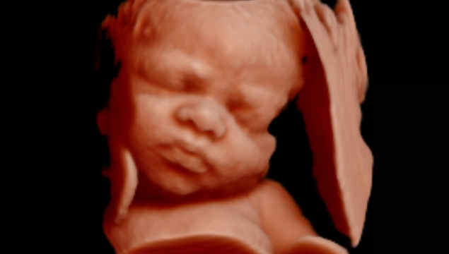 sneak peek 3d ultrasound