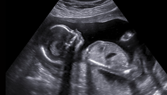 Gallery – Sneak A Peek Ultrasound